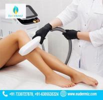 Primelase HR Laser for Hair Removal Treatment in Hyderabad