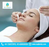 Chemical Peels Treatment in Hyderabad