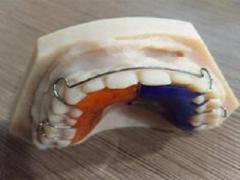 Precision Craftsmanship: Premier China Dental Lab