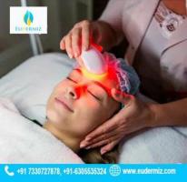 Low-Level Laser Therapy (LLLT) for Hair Thinning in Hyderabad