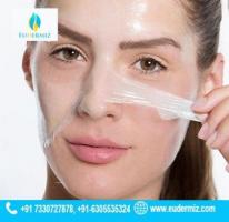 Chemical Peels Treatment in Hyderabad