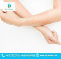 Effective Treatment of skin infections in Hyderabad.