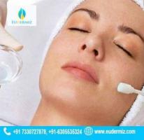 Chemical Peels Treatment in Hyderabad for a Radiant Glow