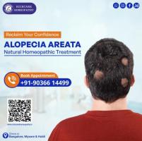 Hair fall Homeopathy Treatments in Bangalore -Rich Care 