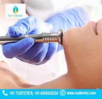 Microdermabrasion Treatment at Eudermiz Clinic, Hyderabad