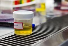 Convenient and Reliable Urine Sample Collection Containers for Medical Testing