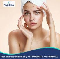 Best Acne Treatment Doctors in Hyderabad