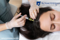 Growth Factor and Alopecia Treatment in Delhi | Advanced Hair Restoration at Kosmoderma