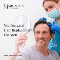 non surgical hair restoration