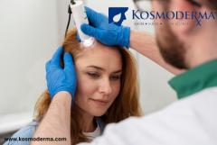 Advanced Laser Hair Growth Treatment in Delhi at Kosmoderma