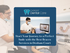 Achieve a Perfect Smile with Braces in Denham Court