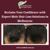 Regain Your Confidence with Aushair's Male Hair Loss Solution