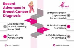 Breast Cancer Stages Symptoms in Chennai