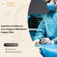 Experience Excellence in Liver Surgery at MH Robotic Surgery Clinic