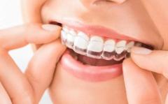 Find the Best Invisible Braces for a Perfectly Aligned Smile