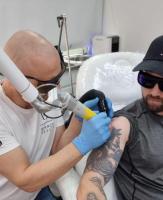 Choose The Expert Tattoo Removal Clinic in London