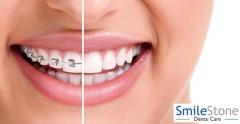 best orthodontist in Nagpur