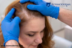 Effective Scalp Scar Removal Treatments in Mumbai | Kosmoderma Skin & Hair Clinic Santacruz