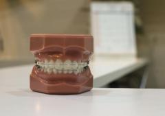 Orthodontics Plano for a Confident Smile