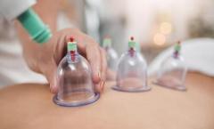 Revitalize Your Body with Expert Cupping Therapy at A&M Health Clinic!