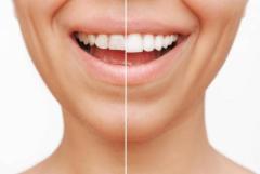 Best dental clinic in Coimbatore 