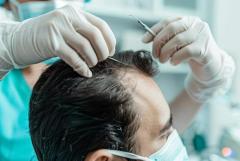 Best Hair Transplant Services in Mumbai – Restore Your Hair Today