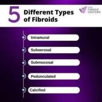 Get Treated for Calcified Fibroid Today!