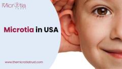 Microtia in the USA