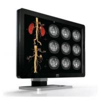 Medical Grade Monitors – Reliable and Clear Displays for Healthcare Professionals