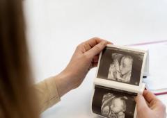 4d sonography in pregnancy