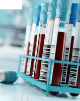 AV Consumable’s Vacuette Blood Collection Sets: The Ideal Solution for Healthcare Providers