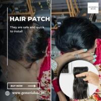 Transform Your Look: Buy Hair Patches for Women Today!