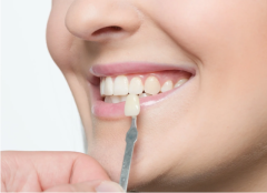 Get Stunning Results with The Smile Spa's Professional Teeth Whitening Services