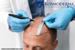 Kosmoderma: Premier Hair Transplant Clinic in Bandra West Mumbai