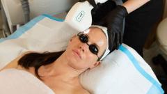 Acne Laser Treatment