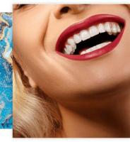 Soda City Dentistry: Premier Veneers in Columbia, SC