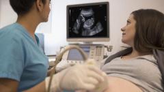 4d sonography in pregnancy