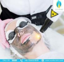 Rejuvenate Your Skin with Carbon Laser Peel at Eudermiz Clinic