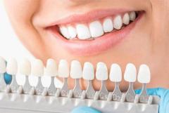 Cost of Veneers for 2 Front Teeth: A Guide