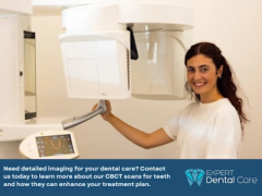 Advanced CBCT Scans for Teeth