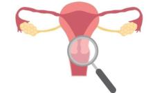 Intramural Leiomyoma of the Uterus: Understanding Symptoms and Treatments