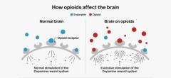 Opioid Abuse Treatment & Rehab Centers in India | FindRehabCentres