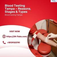 Comprehensive Blood Testing Tampa – Reasons, Stages & Types