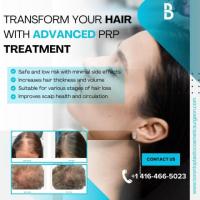 Transform Your Hair with Advanced PRP Treatment