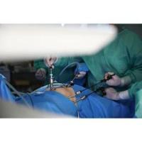 Role of Laparoscopy in Infertility 