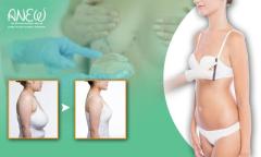 Breast Reduction Surgery in Bangalore: Anew Cosmetic Centre 