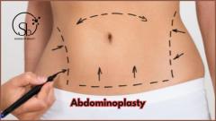 Abdominoplasty In Hyderabad