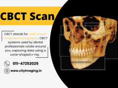 Find a Convenient CBCT Scan Near Me for Accurate Imaging