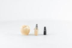 Best Dental Crowns in Calgary: Restore Your Smile