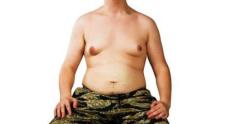 How do I Know If  I Have Gynecomastia?